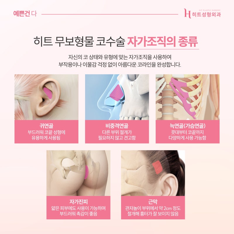 [히트성형외과] 무보형물 코 누구나 가능할까? 사진 3