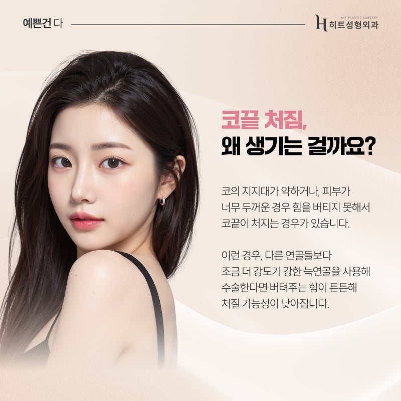 [히트성형외과] 코끝 처짐, 재료에 따라 달라질까요? 사진 3