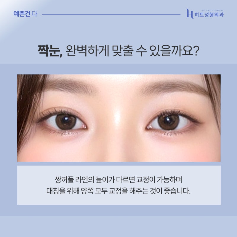 [히트성형외과] 짝눈, 어떤 식으로 수술해야 할까? 사진 5