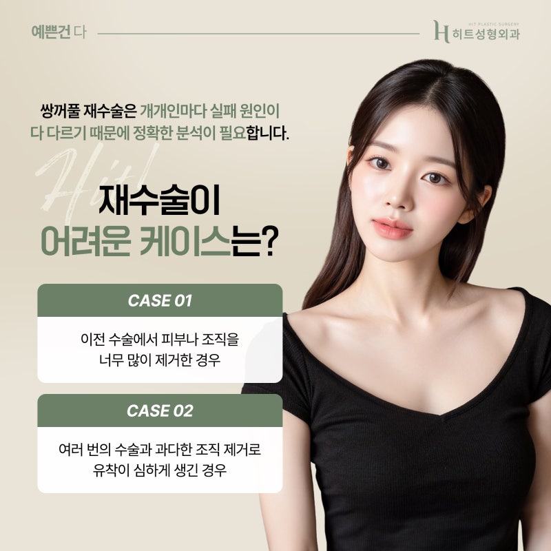 [히트성형외과] 쌍꺼풀 재수술 무조건 가능할까요? 사진 3