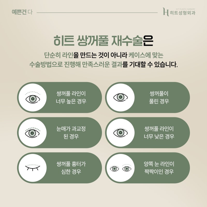 [히트성형외과] 쌍꺼풀 재수술 무조건 가능할까요? 사진 4