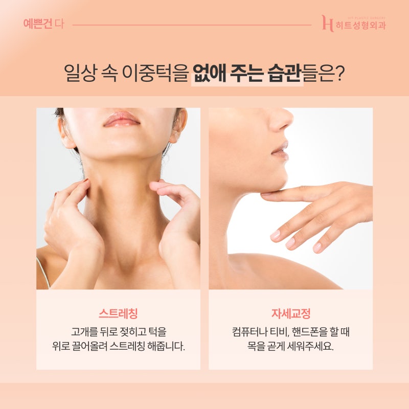 [히트성형외과] 이중턱이 생기는 이유와 습관! 사진 3