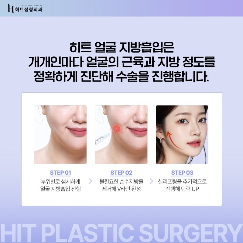 [히트성형외과] 나이가 들어도 젖살이 빠지지 않는다면? 사진 3