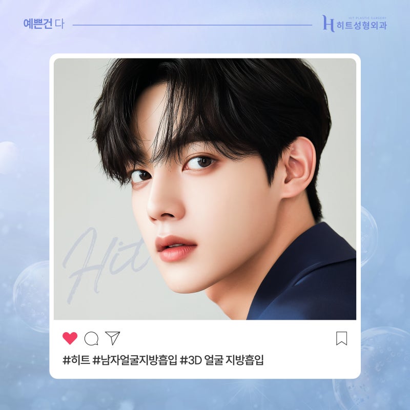[히트성형외과] 히트 남자 얼굴 지방흡입! 어떤 차이가 있을까? 사진 5