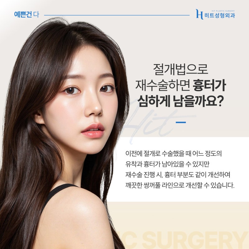 [히트성형외과] 눈 재수술 자연유착으로 가능할까? 사진 5