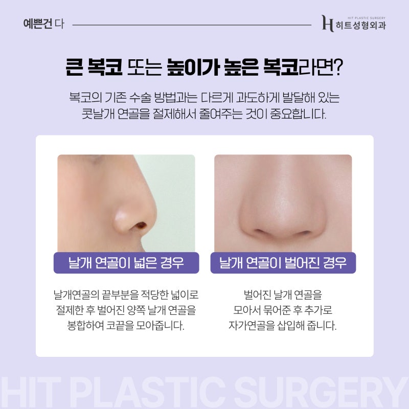 [히트성형외과] 작은 코와 복코 수술 방법이 어떻게 다를까요? 사진 5