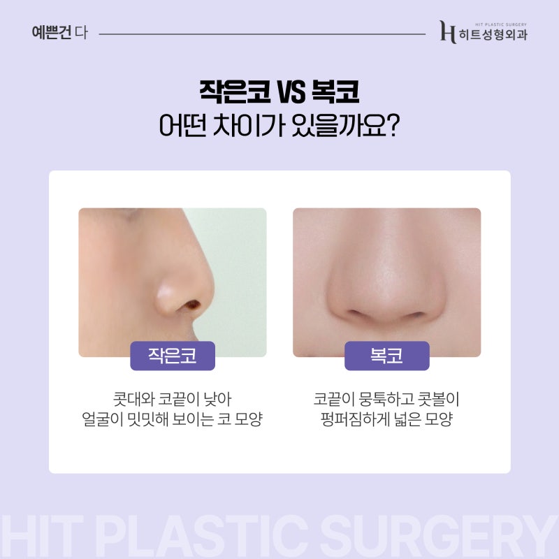 [히트성형외과] 작은 코와 복코 수술 방법이 어떻게 다를까요?