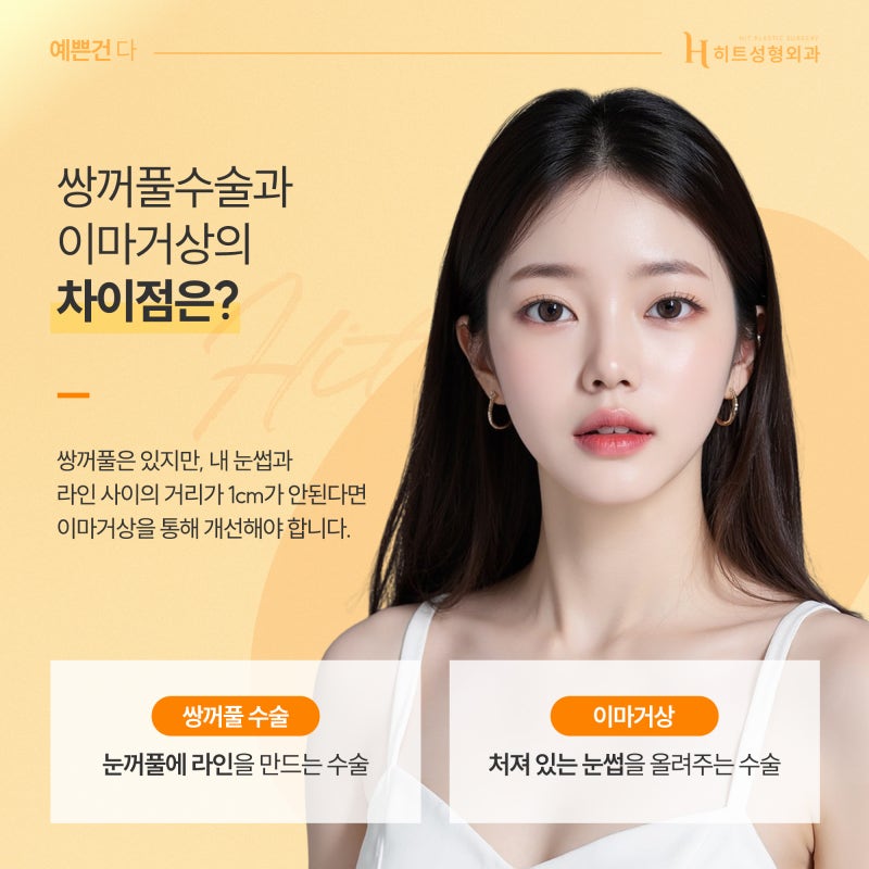 [히트성형외과] 쌍꺼풀 수술 or 이마거상! 나에게 맞는 수술 방법은? 사진 3