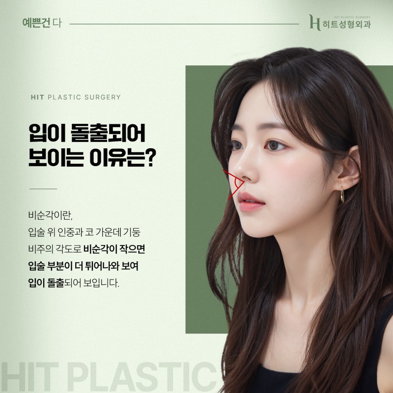 [히트성형외과] 비순각교정으로 튀어나온 입을 개선할 수 있다?