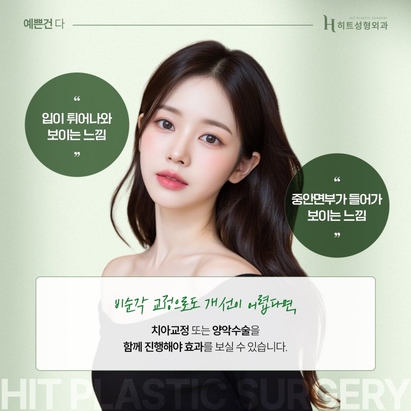[히트성형외과] 비순각교정으로 튀어나온 입을 개선할 수 있다? 사진 5