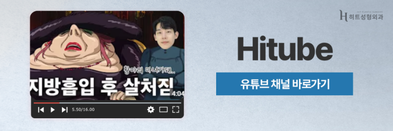 [히트성형외과] 뼈 수술 없이 갸름해지는 방법? 심부볼 지방 흡입! 사진 8