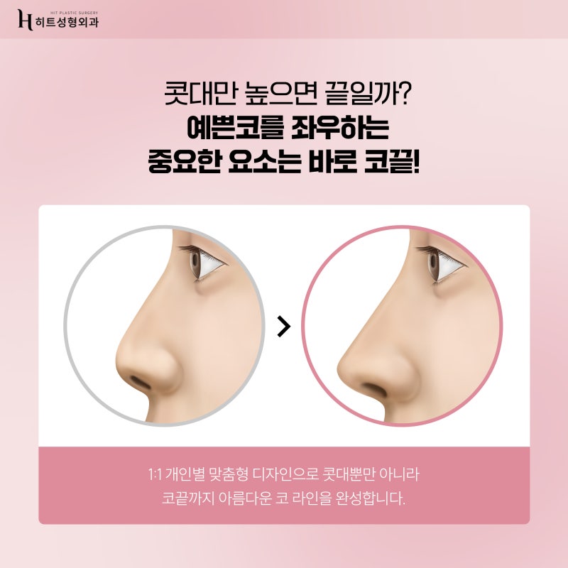 [히트성형외과] 콧대만 예쁘게? NO 코끝까지 완성도 있게!