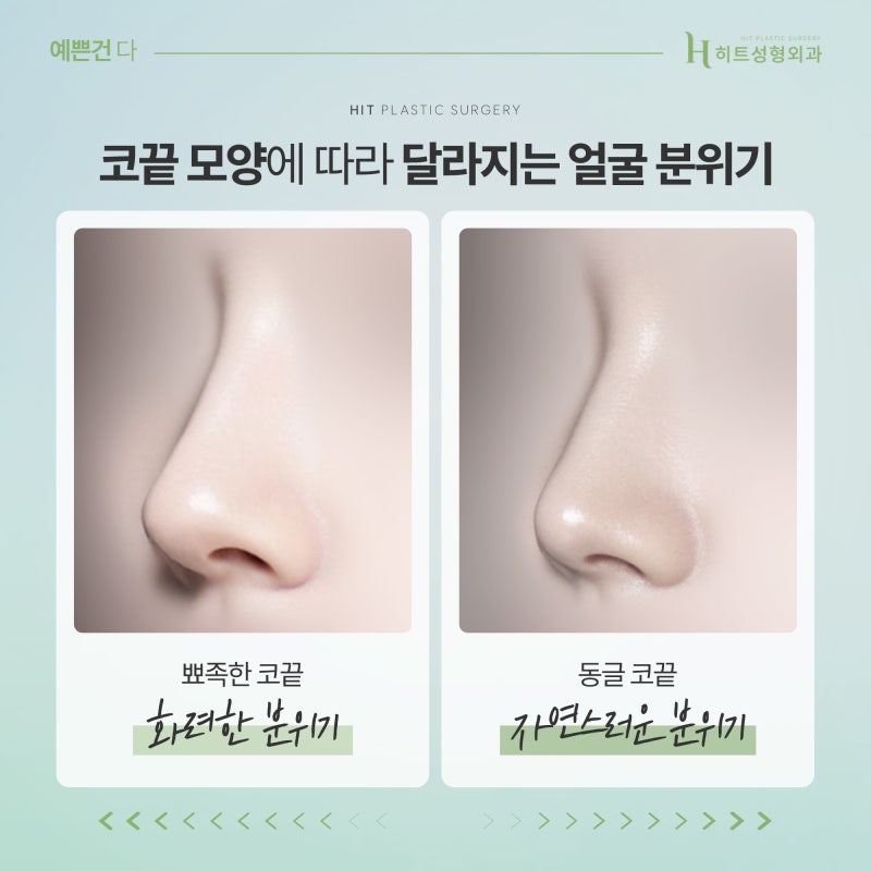 [히트성형외과] 코끝 모양으로 얼굴의 분위기가 결정된다? 사진 3
