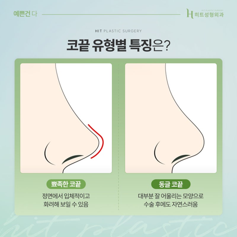 [히트성형외과] 코끝 모양으로 얼굴의 분위기가 결정된다? 사진 4