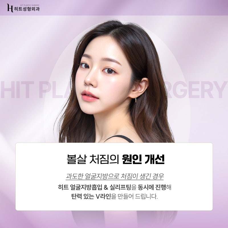 [히트성형외과] 얼굴지방흡입과 안면거상의 차이점은? 사진 4