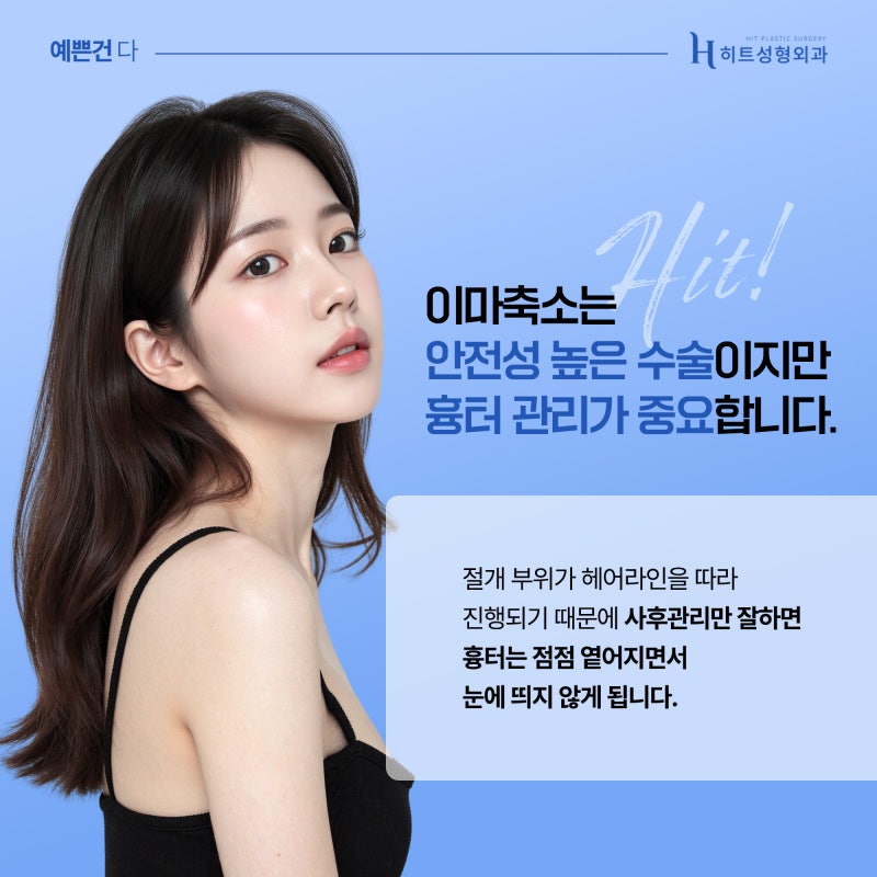 [히트성형외과] 이마축소, 얼마나 줄일 수 있을까? 사진 4