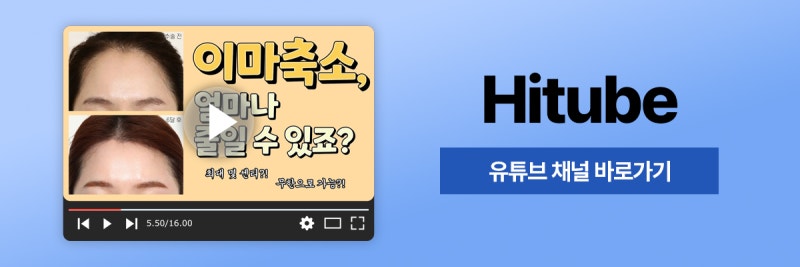[히트성형외과] 이마축소, 얼마나 줄일 수 있을까? 사진 8