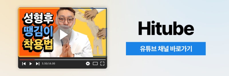 [히트성형외과] 얼굴지방흡입 후 꼭 땡김이를 해야 할까? 사진 8