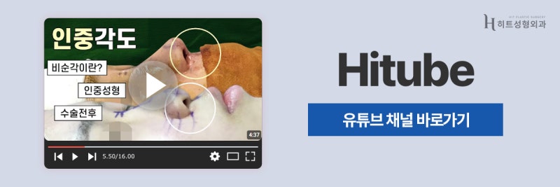 [히트성형외과] 코 성형 시 비순각을 고려해야 하는 이유는? 사진 8