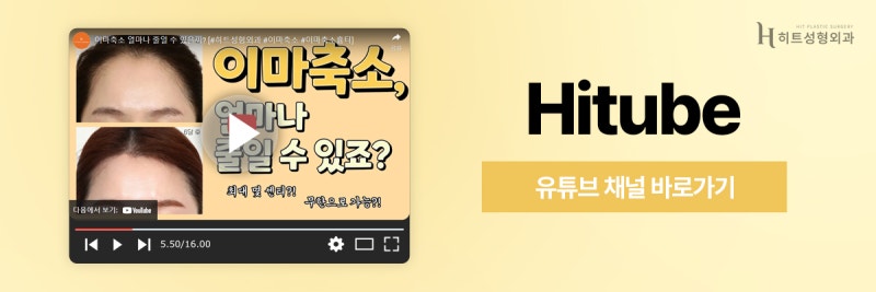 [히트성형외과] 이마거상 후 넓은 이마 해결 방법은? 사진 8