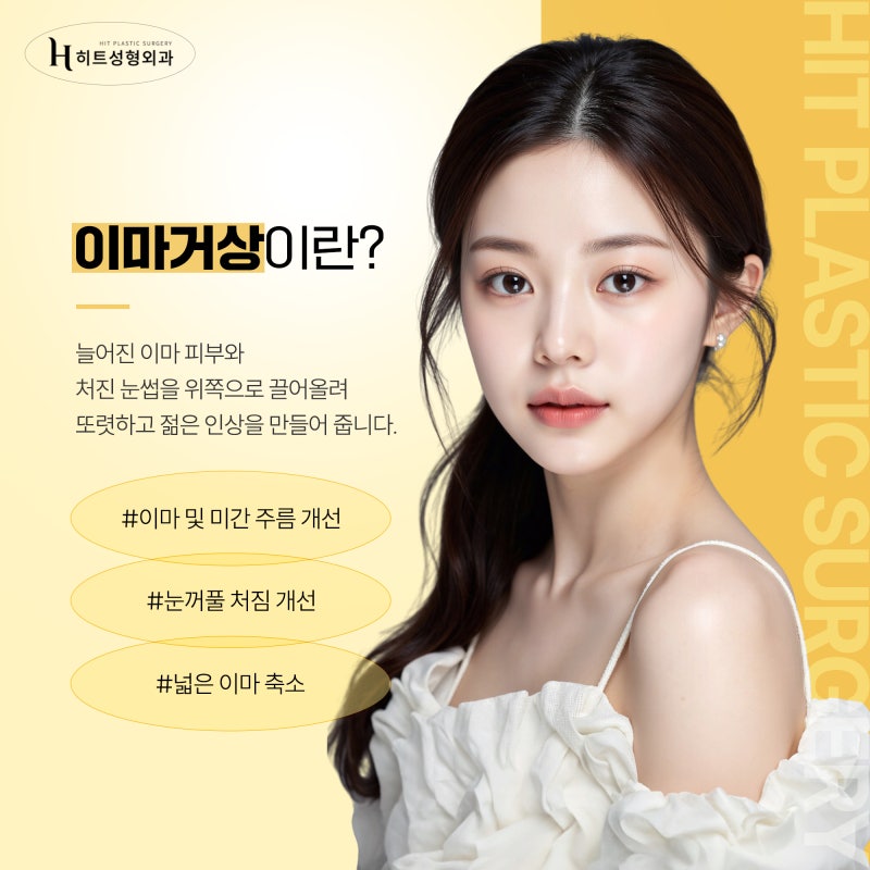 [히트성형외과] 이마거상 후 넓은 이마 해결 방법은?