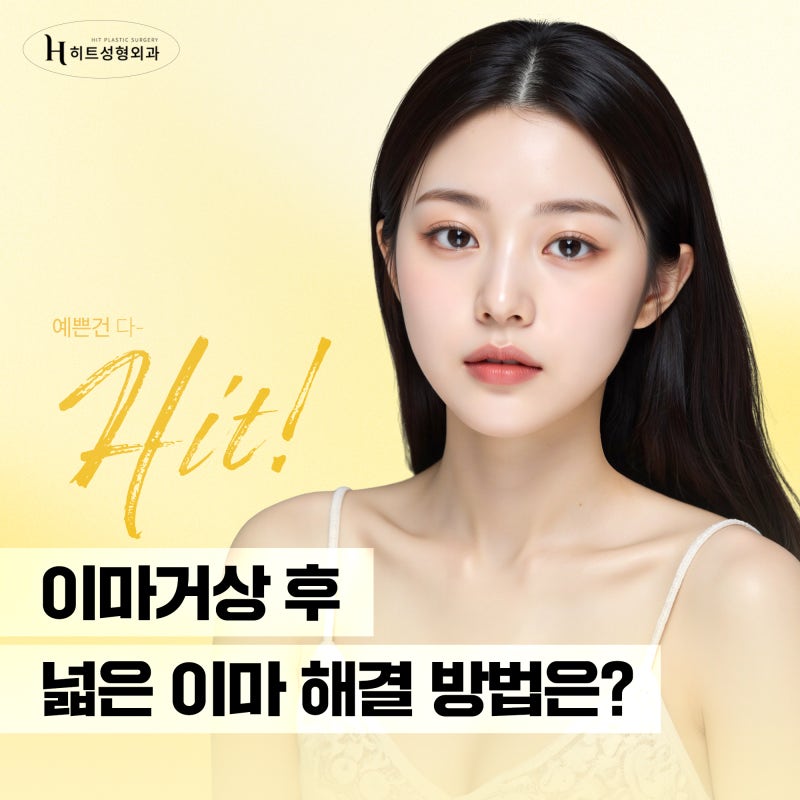 [히트성형외과] 이마거상 후 넓은 이마 해결 방법은?