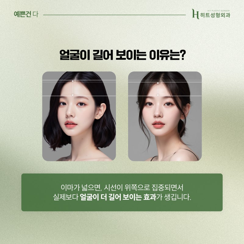 [히트성형외과] 넓은 이마로 길어 보이는 얼굴엔, 히트 이마축소!