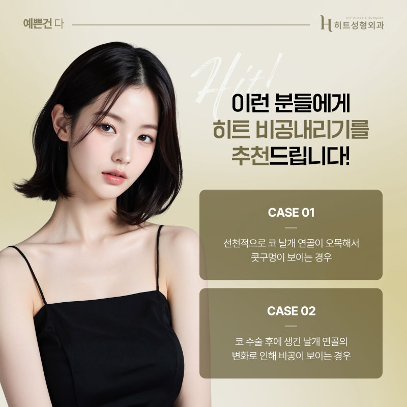 [히트성형외과] 콧구멍이 잘 보이는 코, 내 코도 들창코일까? 사진 4
