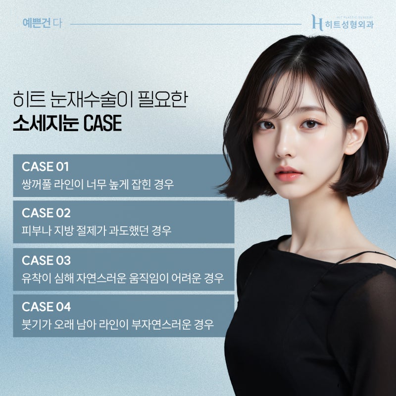 [히트성형외과] 쌍꺼풀 수술 후 소세지 눈이 되었다면? (feat. 쌍꺼풀 재수술)