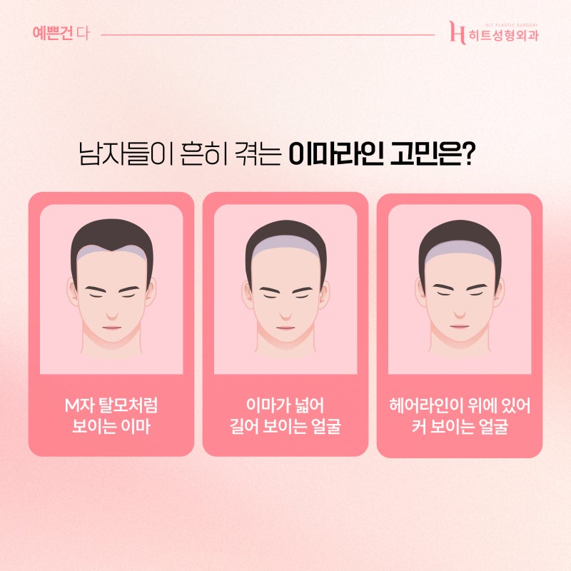[히트성형외과] 남자 이마축소에 대한 모든 것! 사진 3
