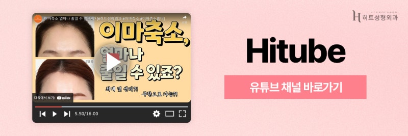 [히트성형외과] 남자 이마축소에 대한 모든 것! 사진 7