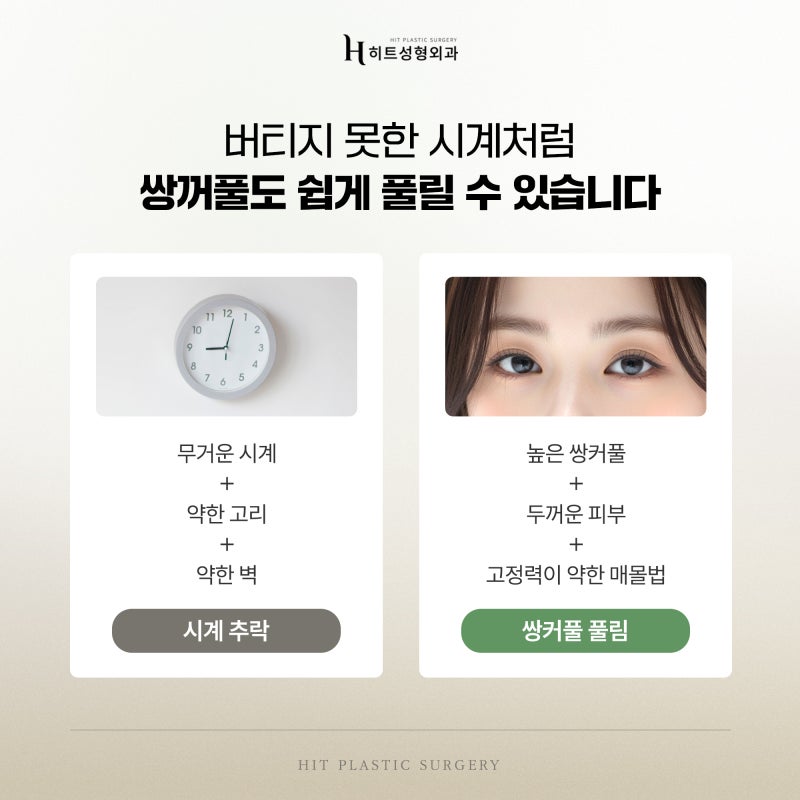 [히트성형외과] 내 쌍꺼풀이 자꾸 풀리는 원인과 해결 방법은? 사진 4