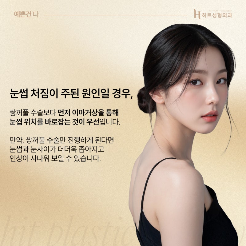 [히트성형외과] 이마거상과 쌍꺼풀 수술, 나에겐 어떤 방법이? 사진 4
