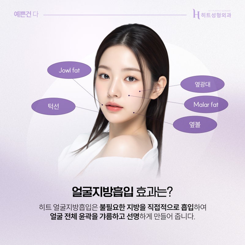 [히트성형외과] 얼굴지방흡입 VS 윤곽 주사, 차이점은? 사진 3