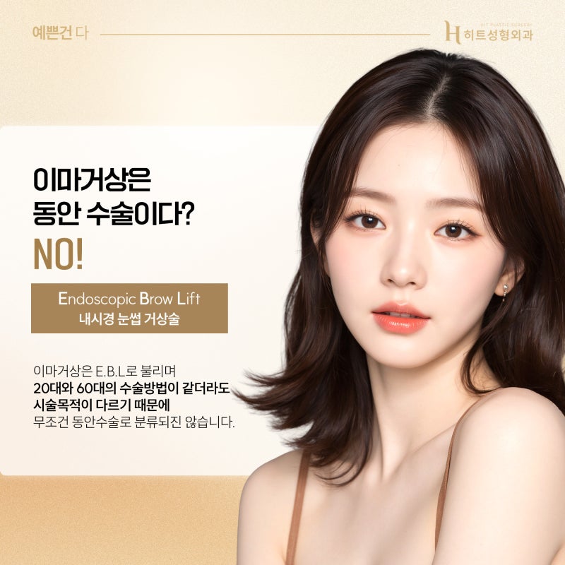 [히트성형외과] 20대 이마거상에 대한 진실은?