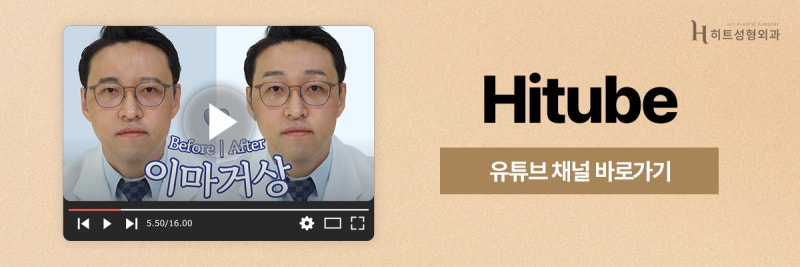 [히트성형외과] 20대 이마거상에 대한 진실은? 사진 8