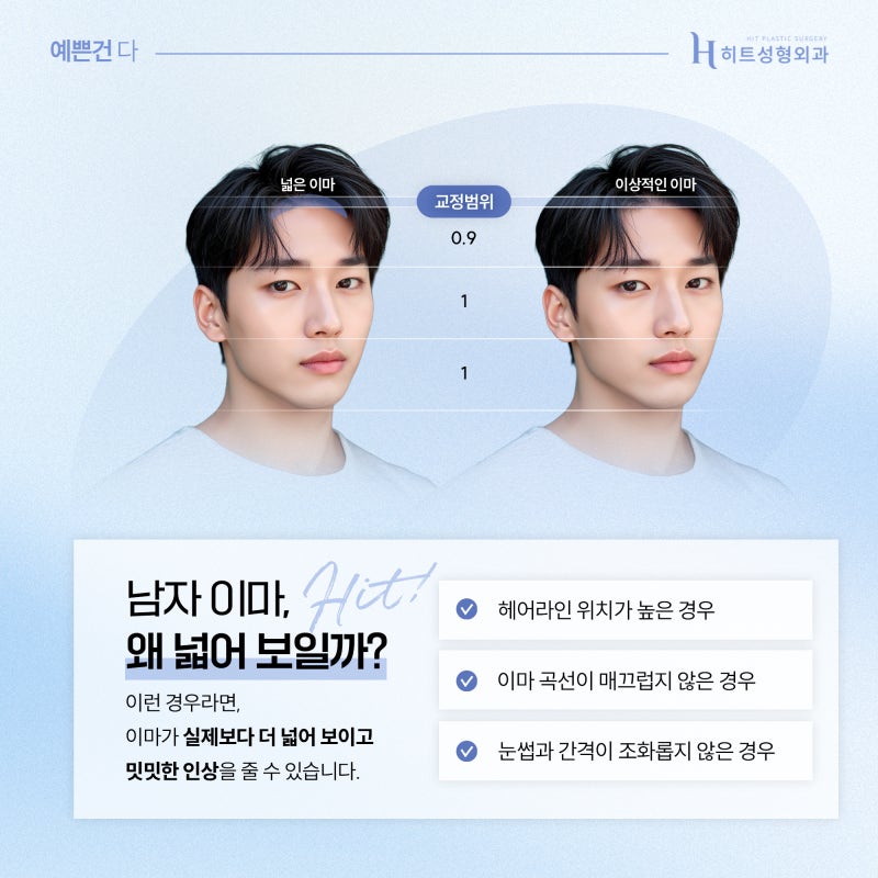 [히트성형외과] 넓은 이마가 고민이라면? 자연스러운 남자 이마축소로!