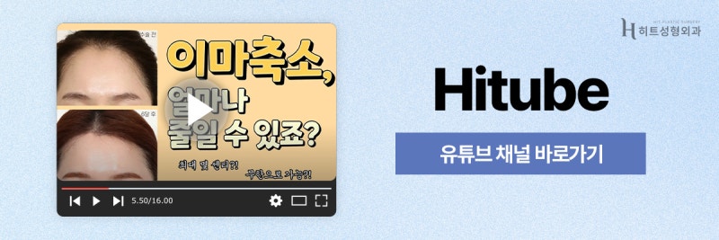 [히트성형외과] 넓은 이마가 고민이라면? 자연스러운 남자 이마축소로! 사진 8