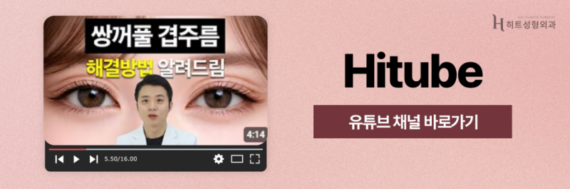 [히트성형외과] 중년의 쌍꺼풀 고민? 상안검 수술로 자연스럽게! 사진 8