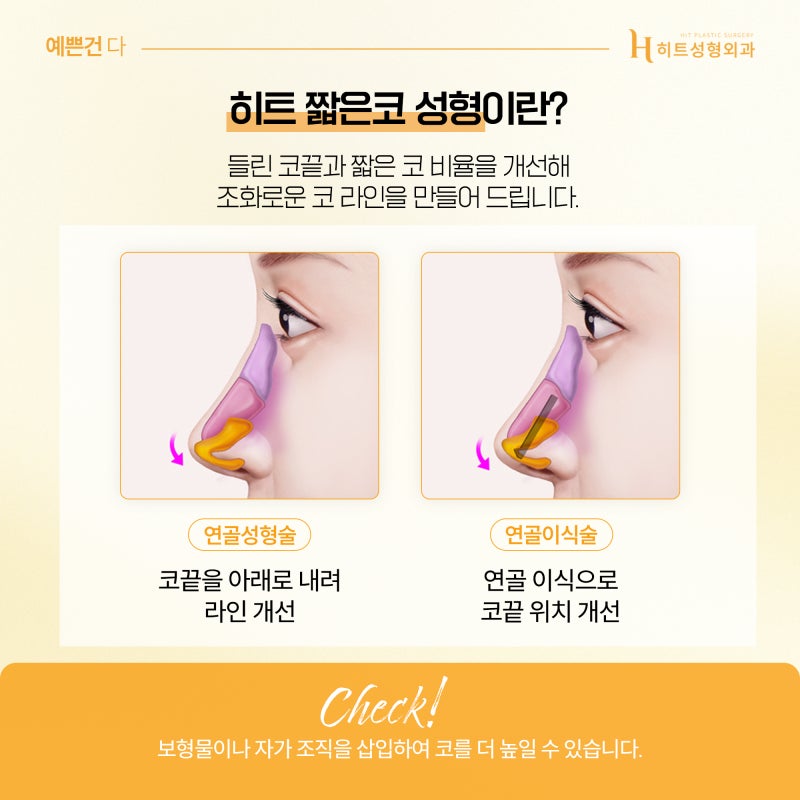 [히트성형외과] 내 코는 어떤 유형일까? 사진 5