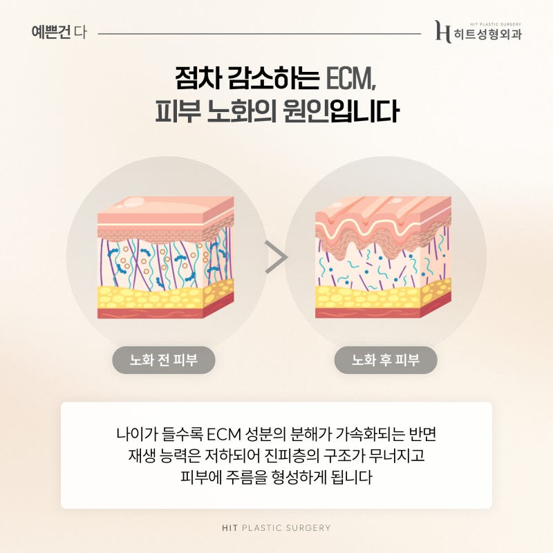 [히트성형외과] 엘라비에 리투오, 왜 사람들이 주목하는 걸까?