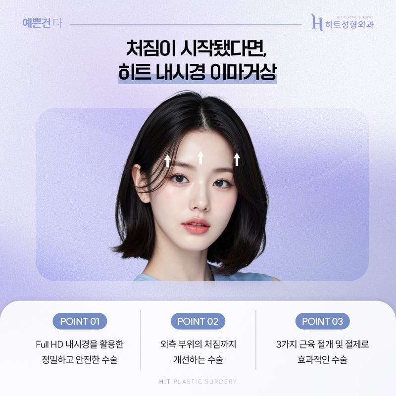 [히트성형외과] 내시경 이마거상의 효과 정리! 사진 5