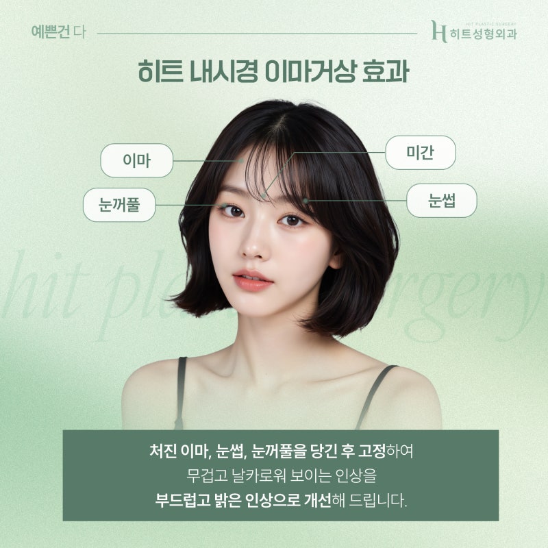 [히트성형외과] 내시경 이마거상의 놀라운 변화! 사진 4