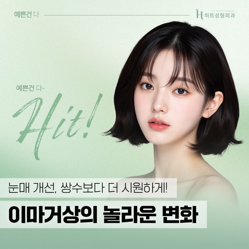 [히트성형외과] 내시경 이마거상의 놀라운 변화!