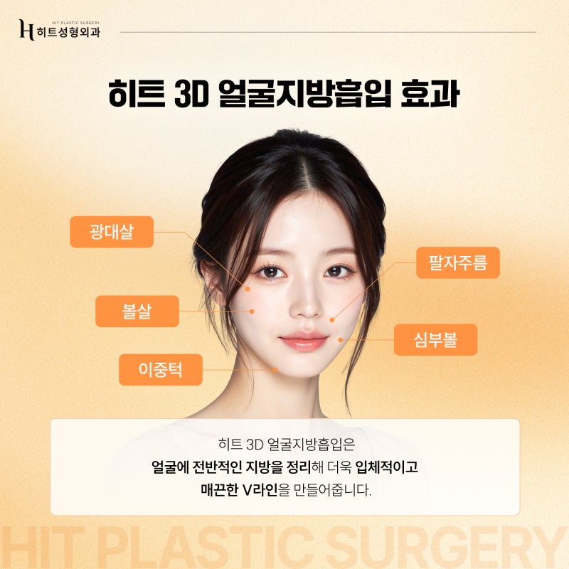 [히트성형외과] 얼굴지방흡입! 디자인이 중요한 이유는? 사진 4
