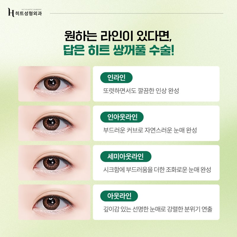 [히트성형외과] 인아웃라인 쌍꺼풀, 꾸준히 인기인 이유! 사진 3