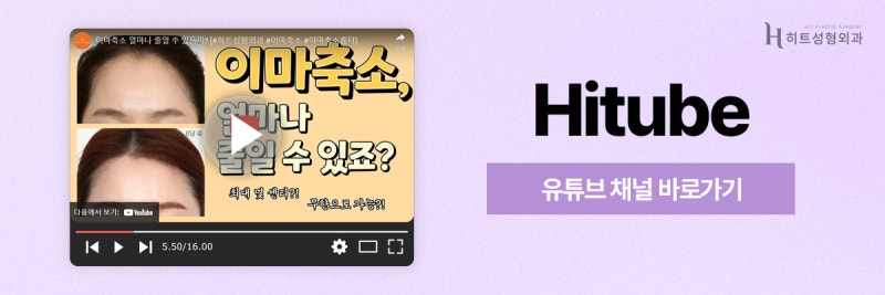 [히트성형외과] 넓은 이마 콤플렉스, 이마축소로 자신감 회복! 사진 8
