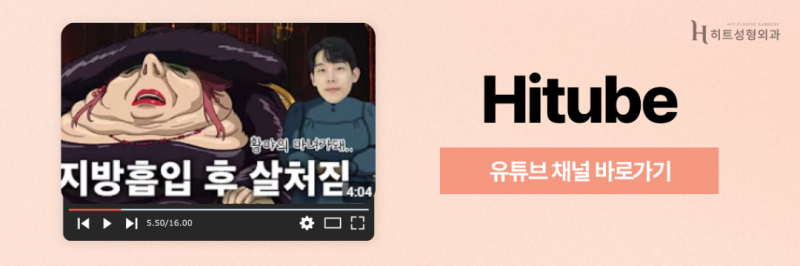 [히트성형외과] 얼굴지방흡입 볼패임 없이 예쁘게 관리하는 법! 사진 8