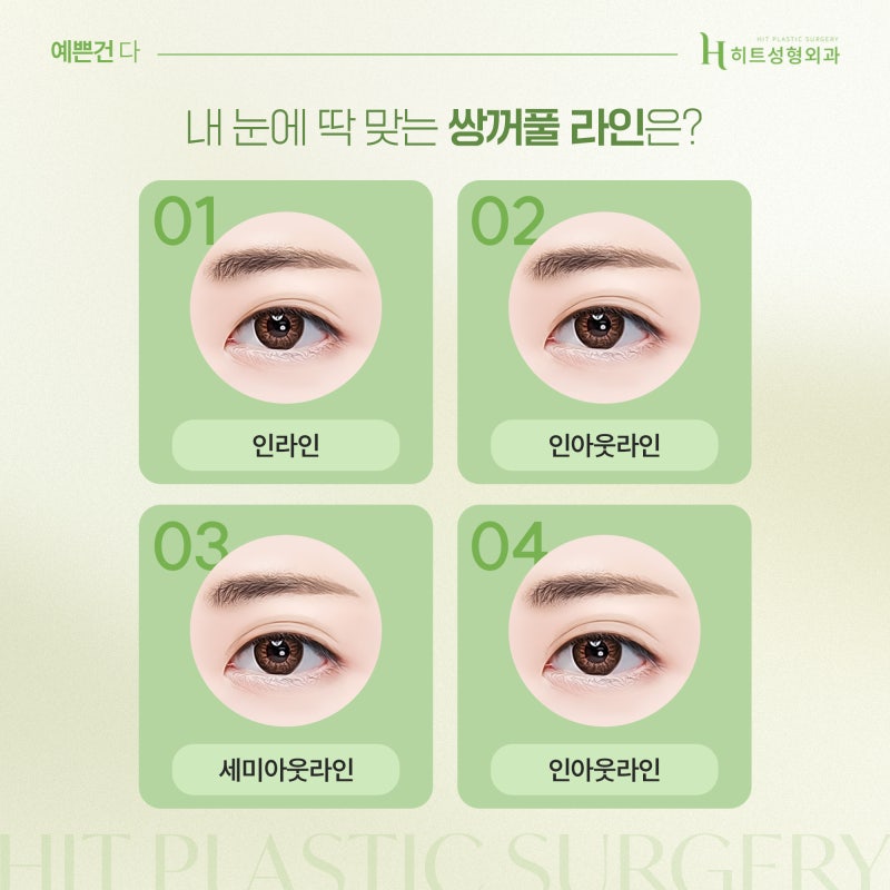 [히트성형외과] 내 눈에 딱 맞는 쌍꺼풀라인, 어떻게 고를까? 사진 3