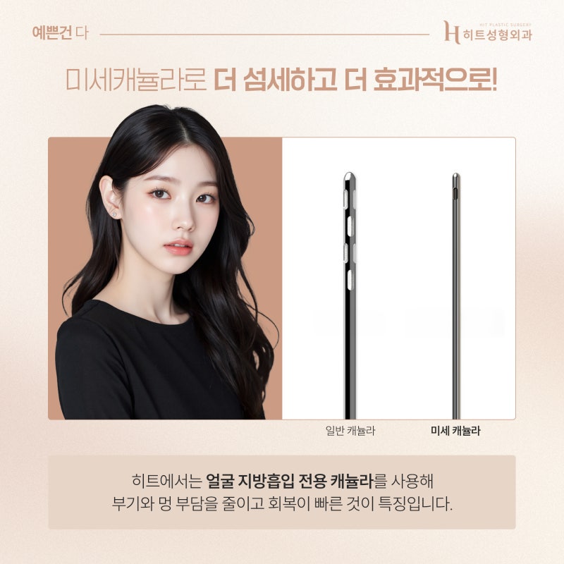 [히트성형외과] 얼굴지방흡입의 모든 것! 인상 변화의 비밀은? 사진 4